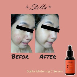 STELLA WHITENING C SERUM