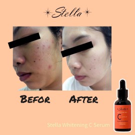 STELLA WHITENING C SERUM